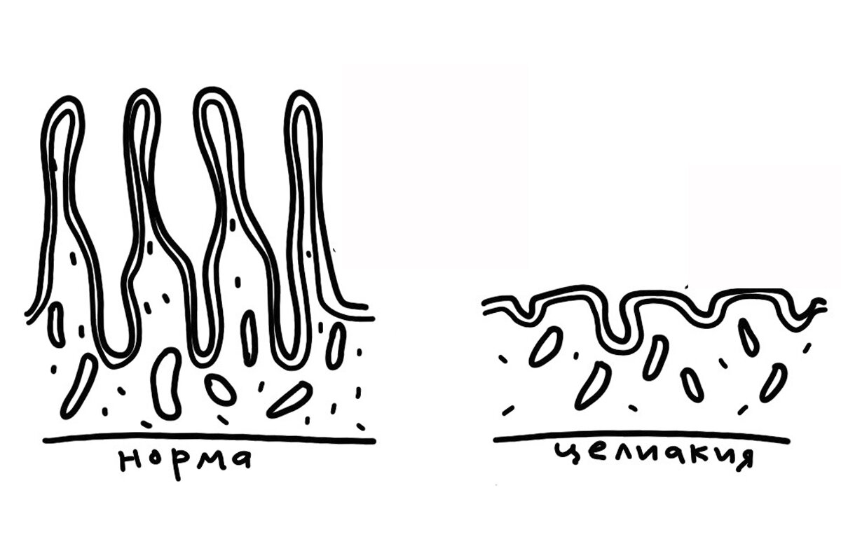 Этот продукт вызывает усталость и быстрое старение, считают некоторые. Другие уверены, отказ от него – главный секрет похудения